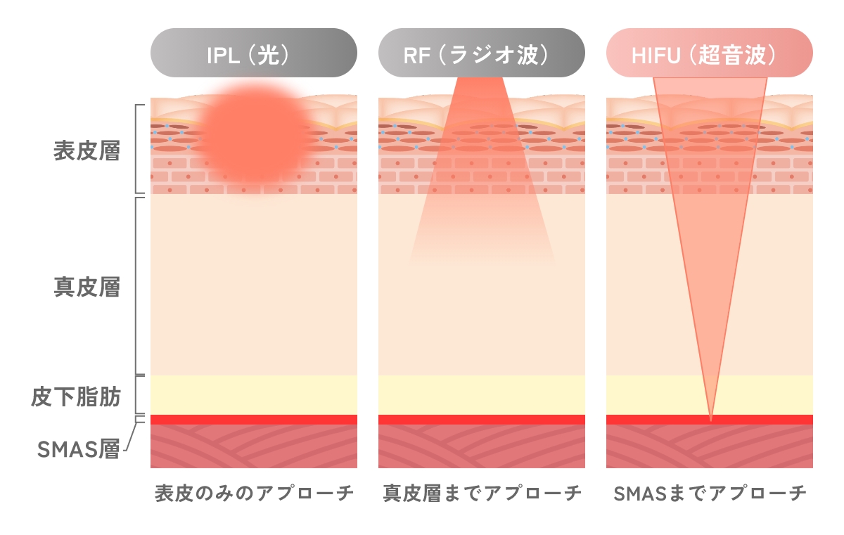 施術の方法