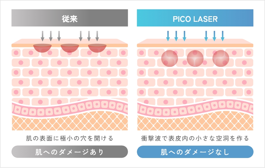 ピコフラクショナルとは