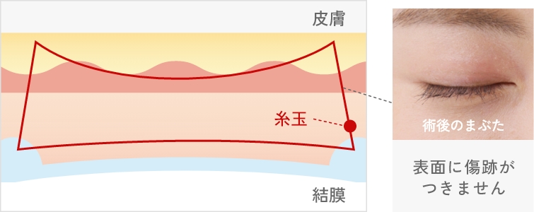 バレない黄金比二重術