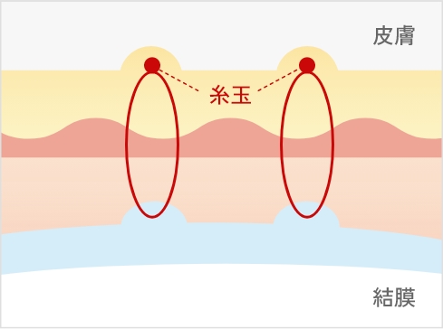 黄金比二重術