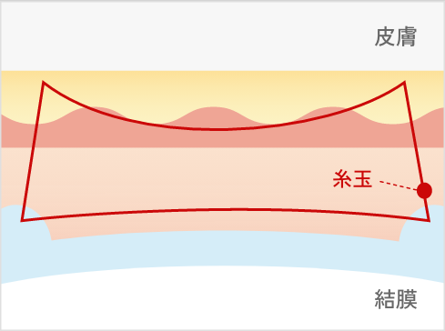 シークレットシングル
