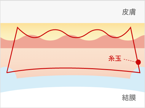 シークレットクロス