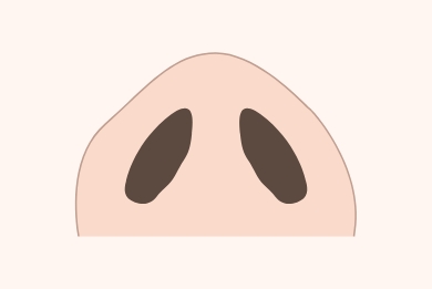 縫合