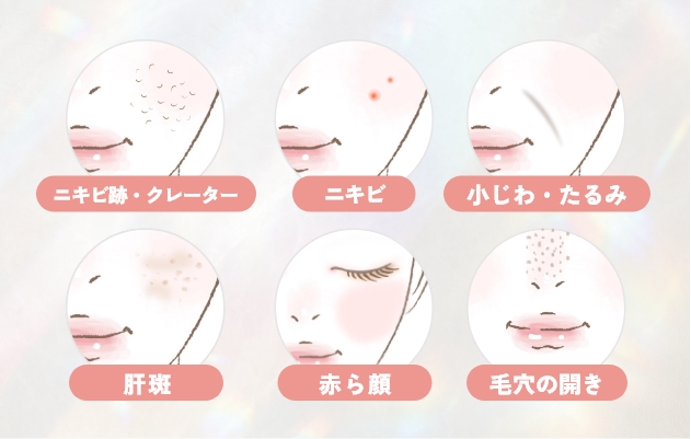 お肌にあった施術をご提案