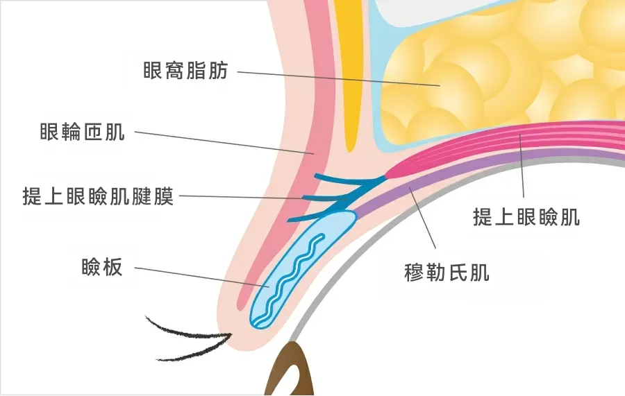 T CLINIC的無痕黃金比例雙眼皮整形介紹