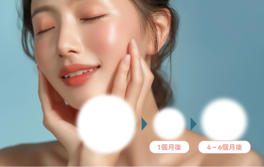 肉毒素注射的維持時間