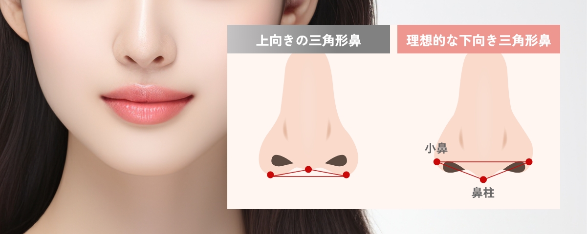 理想的鼻柱是什麼