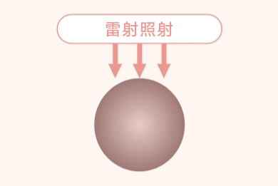 激光照射