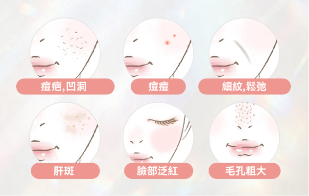 推薦適合膚況的療程