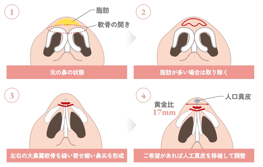 治疗方法
