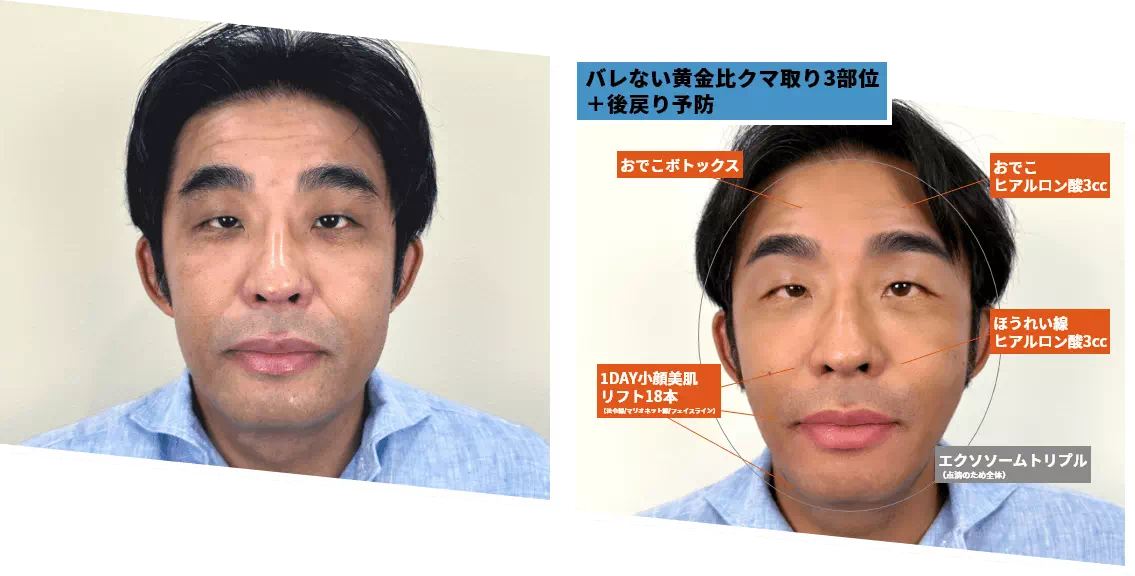 ビフォアーアフター