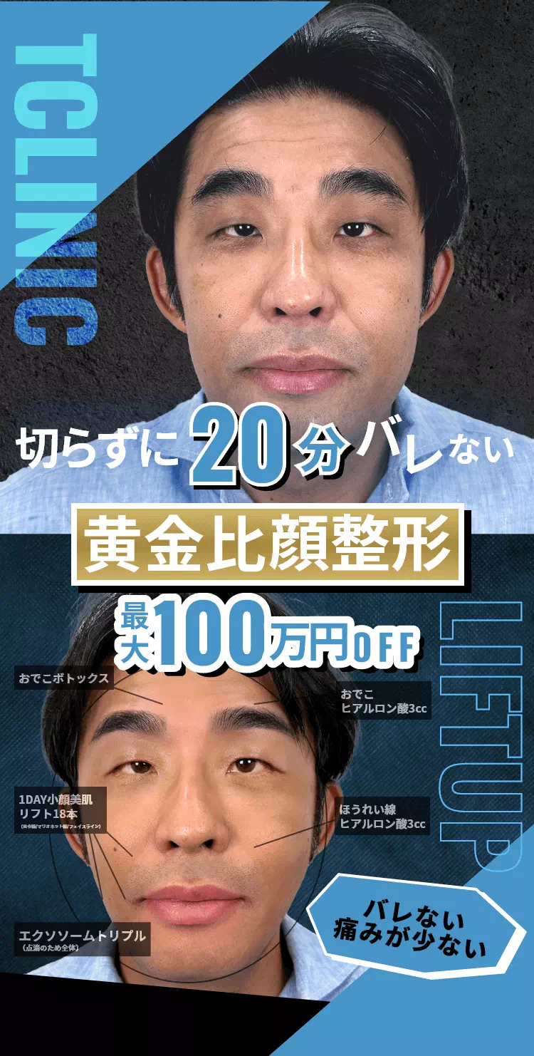 切らずに20分バレない黄金比顔整形