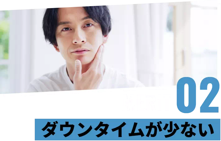 メリット2 ダウンタイムが少ない