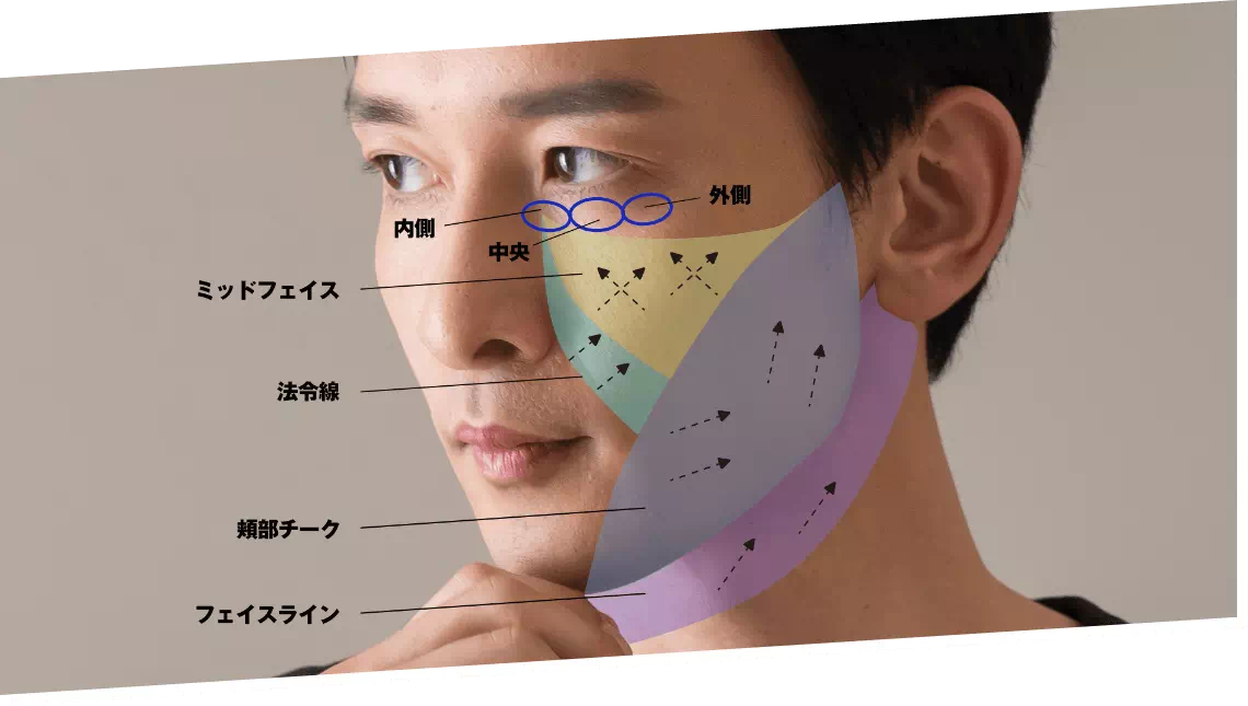整形の内容