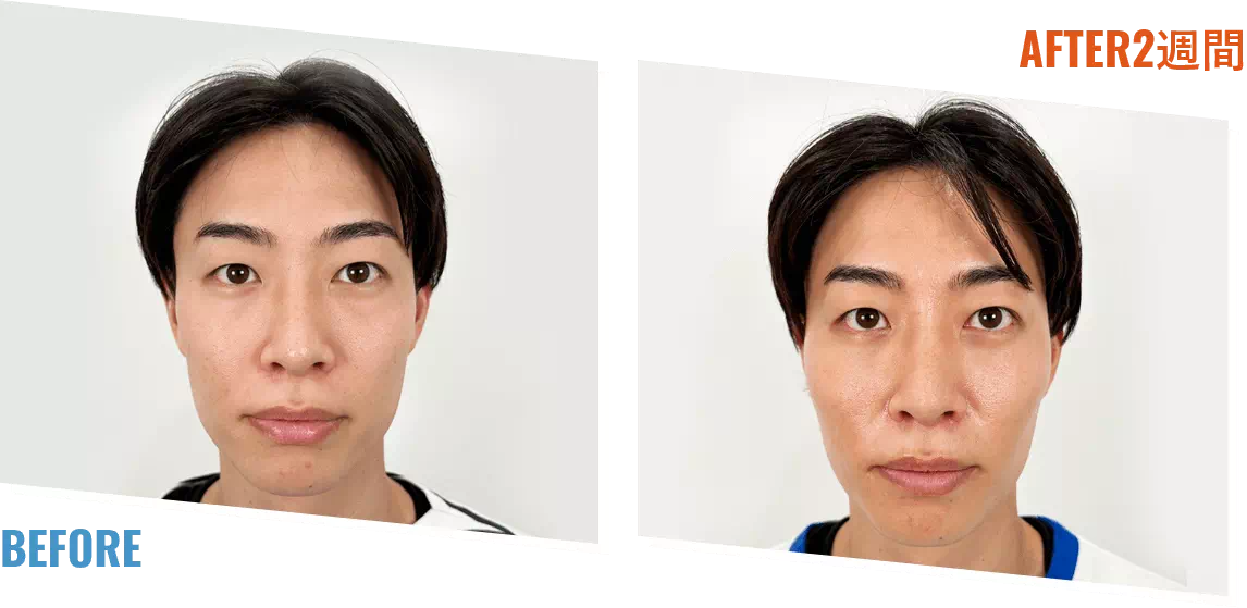 ビフォアーアフター