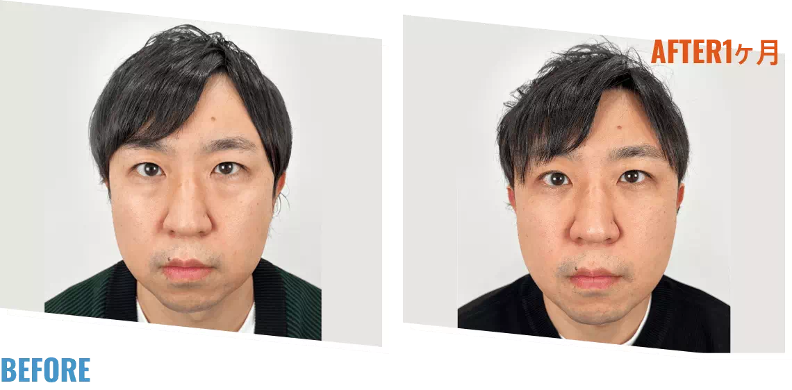 ビフォアーアフター