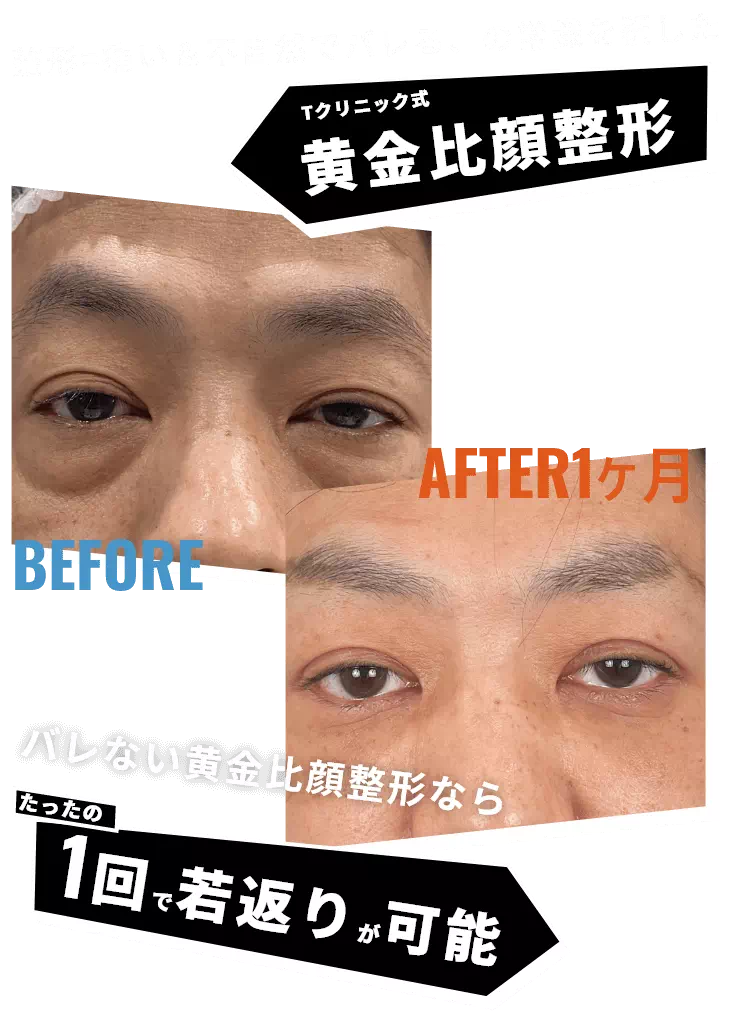 Tクリニック式黄金比顔整形