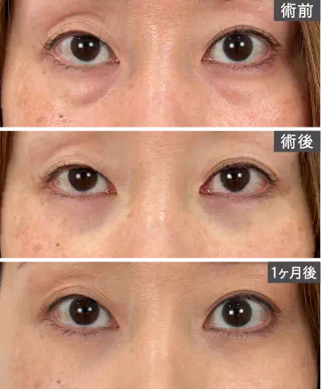 ビフォアーアフター
