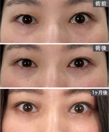 ビフォアーアフター