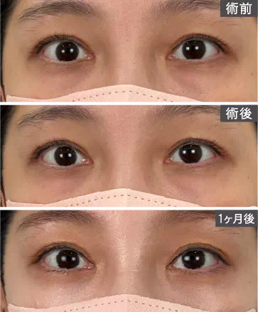 ビフォアーアフター