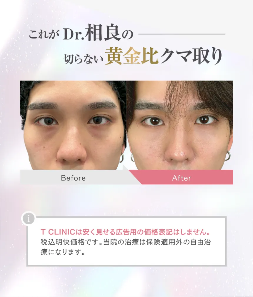 これがDr.相良の切らない黄金比クマ取り