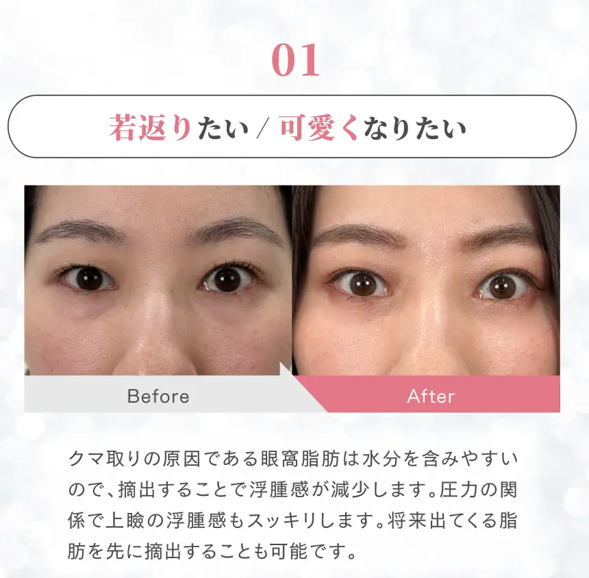 疲れ顔をどうにかしたい