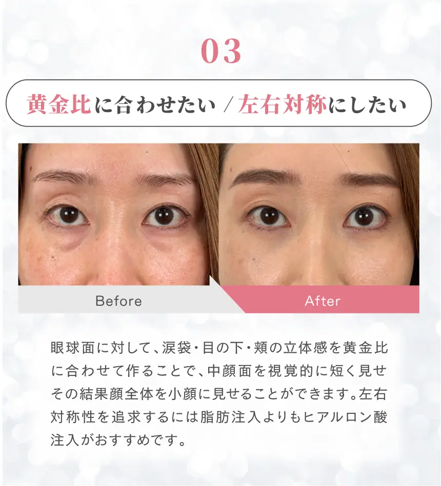 目元のむくみ感が気になる